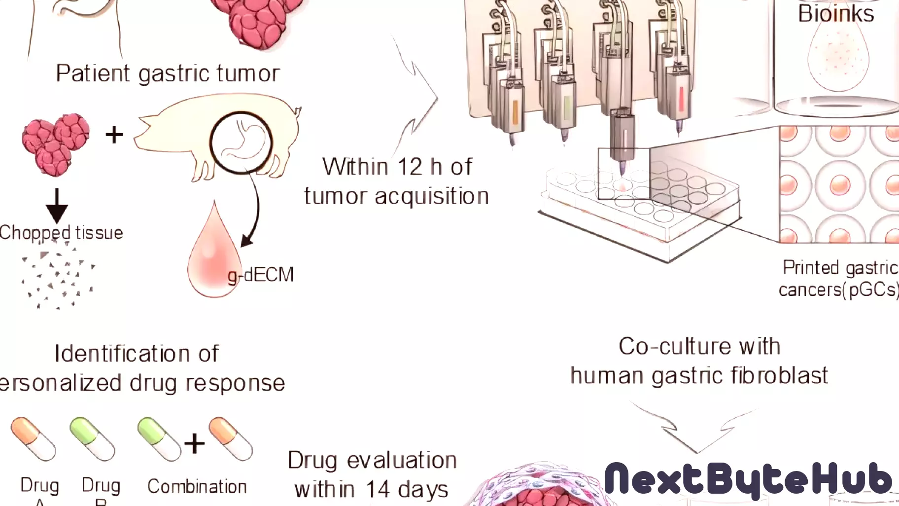 Advancements in 3D Bioprinting Pave the Way for Tailored Gastric Cancer Treatments