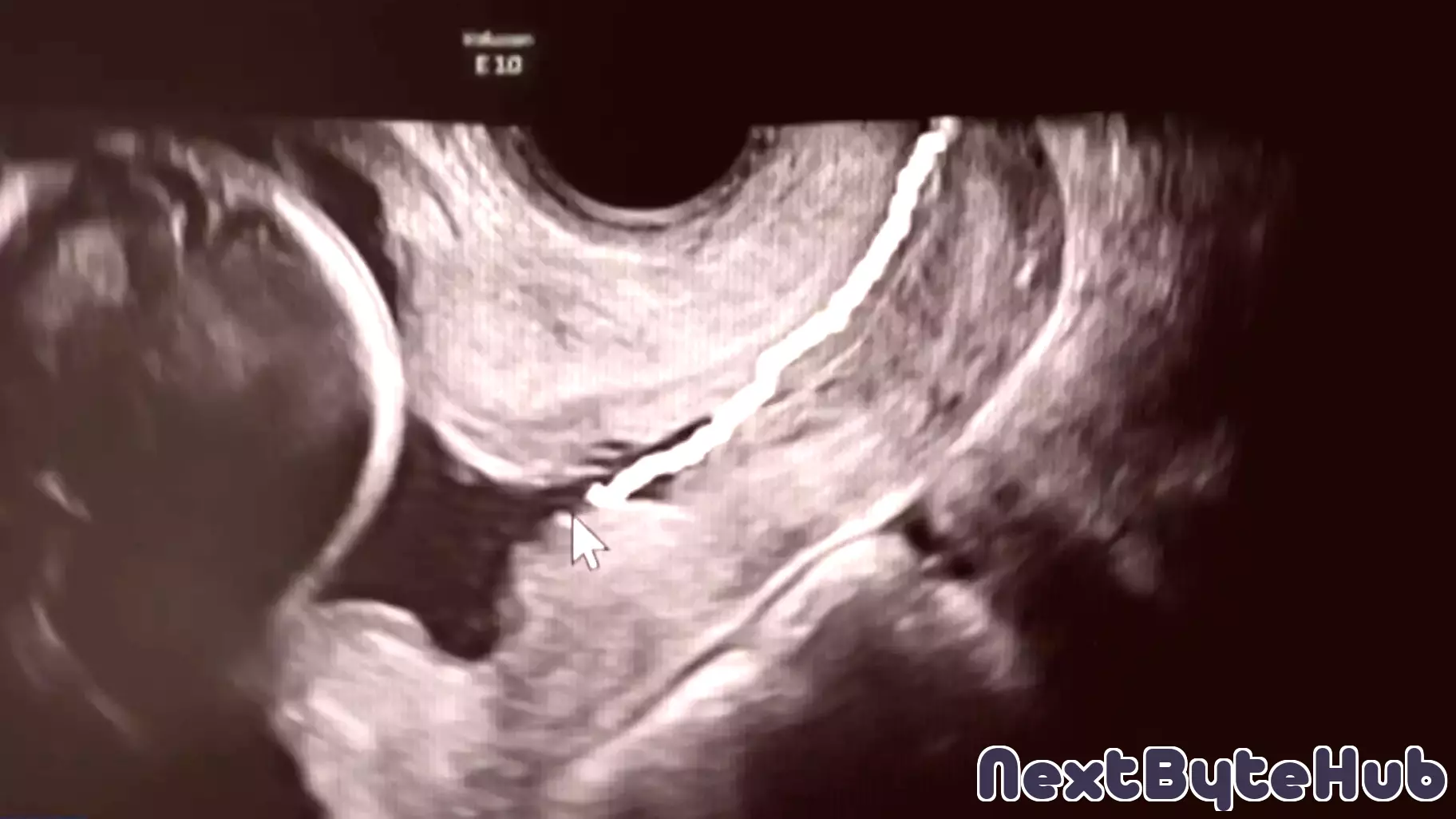 Columbia University Innovates Technology to Monitor Pregnancy and Prevent Premature Births