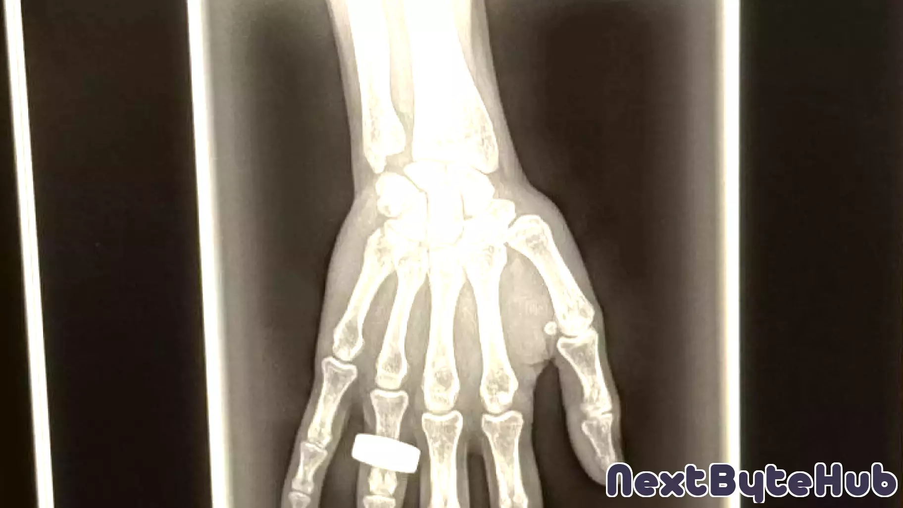 Historic Milestone: First X-ray of an Astronaut in Space Utilizes Local Technology