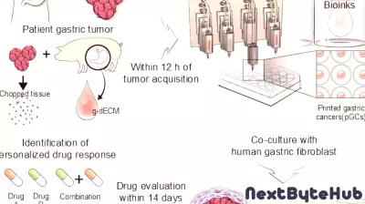 Advancements in 3D Bioprinting Pave the Way for Tailored Gastric Cancer Treatments